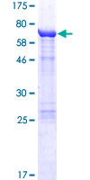 SDS-PAGE - Recombinant Human Keratin 36 protein (AB160141)