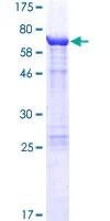 SDS-PAGE - Recombinant Human Keratin 36 protein (GST tag N-Terminus) (AB160141)