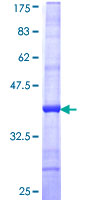 SDS-PAGE - Recombinant Human Keratocan/KTN protein (AB161287)
