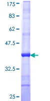 SDS-PAGE - Recombinant Human Keratocan/KTN protein (GST tag N-Terminus) (AB161287)