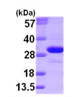 SDS-PAGE - Recombinant Human ketohexokinase protein (AB95395), expandable thumbnail