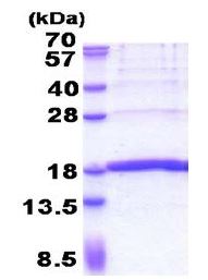 Recombinant Human KHDC1L protein