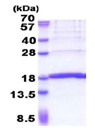 SDS-PAGE - Recombinant Human KHDC1L protein (His tag N-Terminus) (AB171479)