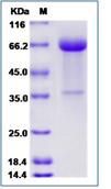 SDS-PAGE - Recombinant Human KI2LA protein (Fc Chimera) (AB276710), expandable thumbnail