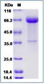 SDS-PAGE - Recombinant Human KI2LA protein (Fc Chimera) (AB276710)