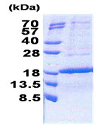 SDS-PAGE - Recombinant Human KIAA0101 protein (His tag N-Terminus) (AB171707)