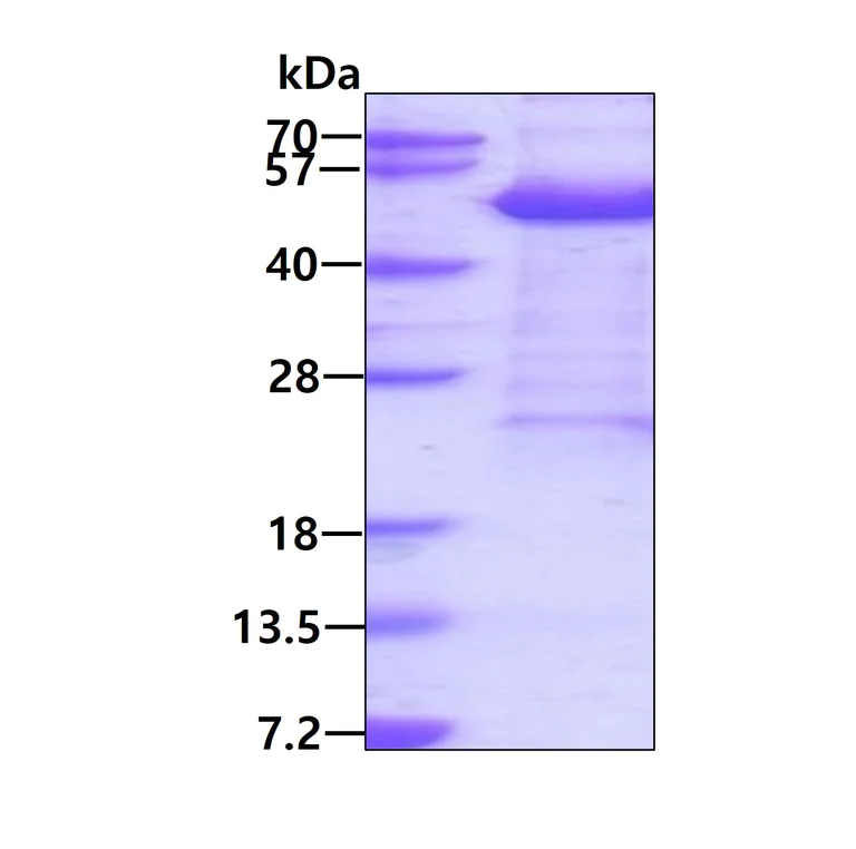 SDS-PAGE - Recombinant Human KIN protein (AB137170)