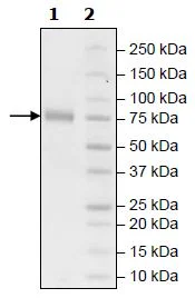 SDS-PAGE - Recombinant Human KIR2DL1 protein (Biotin) (Fc tag C-Terminus + Avi tag C-Terminus) (AB271572)