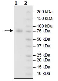 SDS-PAGE - Recombinant Human KIR2DL1 protein (Fc tag C-Terminus + Avi tag C-Terminus) (AB271573)