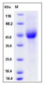 SDS-PAGE - Recombinant Human KIR2DL1 protein (His tag) (AB276502), expandable thumbnail