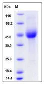 SDS-PAGE - Recombinant Human KIR2DL1 protein (His tag) (AB276502)