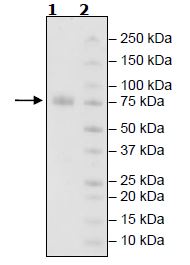 SDS-PAGE - Recombinant Human KIR2DL1 protein (Tagged) (AB271573), expandable thumbnail