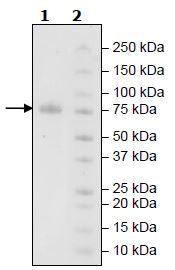 Recombinant Human KIR2DL2 protein (Tagged)