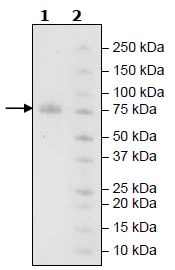 SDS-PAGE - Recombinant Human KIR2DL2 protein (Tagged) (AB271575)