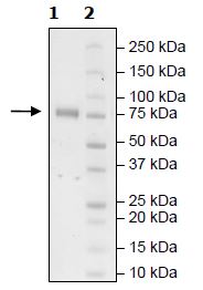 Recombinant Human KIR2DL2 protein (Tagged) (Biotin)
