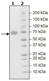 SDS-PAGE - Recombinant Human KIR2DL3 protein (Fc tag C-Terminus + Avi tag C-Terminus) (AB271576)