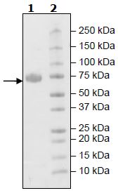 Recombinant Human KIR2DL3 protein (Tagged)