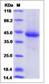 SDS-PAGE - Recombinant Human KIR3DL3 protein (His tag) (AB276711)