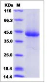 SDS-PAGE - Recombinant Human KIR3DL3 protein (His tag) (AB276711)