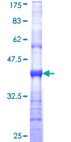 SDS-PAGE - Recombinant Human Kir4.1/KCNJ10 protein (GST tag N-Terminus) (AB114456)