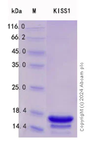SDS-PAGE - Recombinant Human Kisspeptin Protein Standard (His tag) (AB316528)