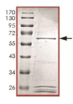 SDS-PAGE - Recombinant Human KIST/KIS protein (AB131703)