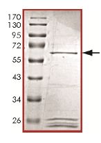 SDS-PAGE - Recombinant Human KIST/KIS protein (AB131703)