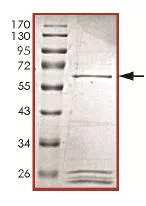 SDS-PAGE - Recombinant Human KIST/KIS protein (AB131703)