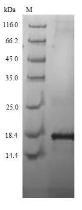 SDS-PAGE - Recombinant Human KK-LC-1 VLP protein (His tag) (AB267882)