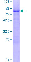 SDS-PAGE - Recombinant Human KLF15 protein (AB131876), expandable thumbnail