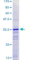 Recombinant Human KLF2 protein