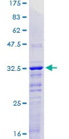 SDS-PAGE - Recombinant Human KLF2 protein (AB160964)