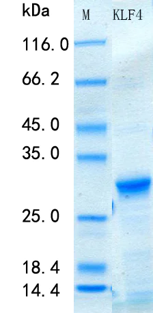 SDS-PAGE - Recombinant Human KLF4 Protein Standard (His tag) (AB316571)