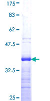 SDS-PAGE - Recombinant Human KLF5 protein (AB157976)