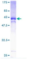 SDS-PAGE - Recombinant Human KLF6 protein (AB114550)