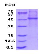 SDS-PAGE - Recombinant Human KLHDC8B protein (denatured) (AB187414), expandable thumbnail