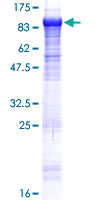 Recombinant Human KLHL22 protein