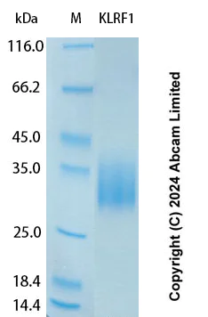 SDS-PAGE - Recombinant Human KLRF1 Protein Standard (His tag) (AB323130)