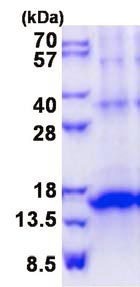 SDS-PAGE - Recombinant Human KLRG1 protein (denatured) (His tag N-Terminus) (AB139253)