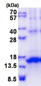 SDS-PAGE - Recombinant Human KLRG1 protein (denatured) (His tag N-Terminus) (AB139253)