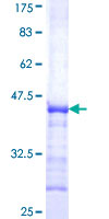 Recombinant Human KMT1E / SETDB1 protein