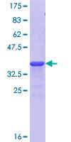 Recombinant Human KMT2D / MLL2 protein