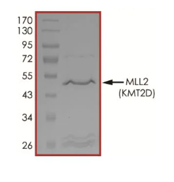SDS-PAGE - Recombinant human KMT2D / MLL2 protein (Active) (AB268800)
