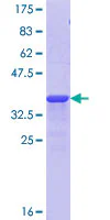 SDS-PAGE - Recombinant Human KMT2D / MLL2 protein (GST tag N-Terminus) (AB152839)