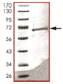 SDS-PAGE - Recombinant Human KMT3C / SMYD2 protein (AB107699)