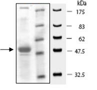 SDS-PAGE - Recombinant Human KMT3C / SMYD2 protein (AB196427)