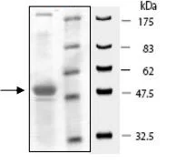 SDS-PAGE - Recombinant Human KMT3C / SMYD2 protein (DDDDK tag N-Terminus) (AB196427)
