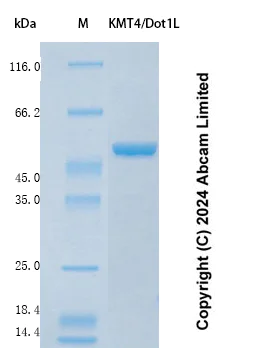 SDS-PAGE - Recombinant Human KMT4/Dot1L Protein Standard (His tag) (AB323152)