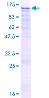 SDS-PAGE - Recombinant Human KMT6 / EZH2 protein (AB132934)