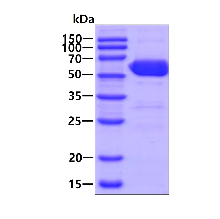 SDS-PAGE - Recombinant Human KPNA2 protein (His tag N-Terminus) (AB123205)